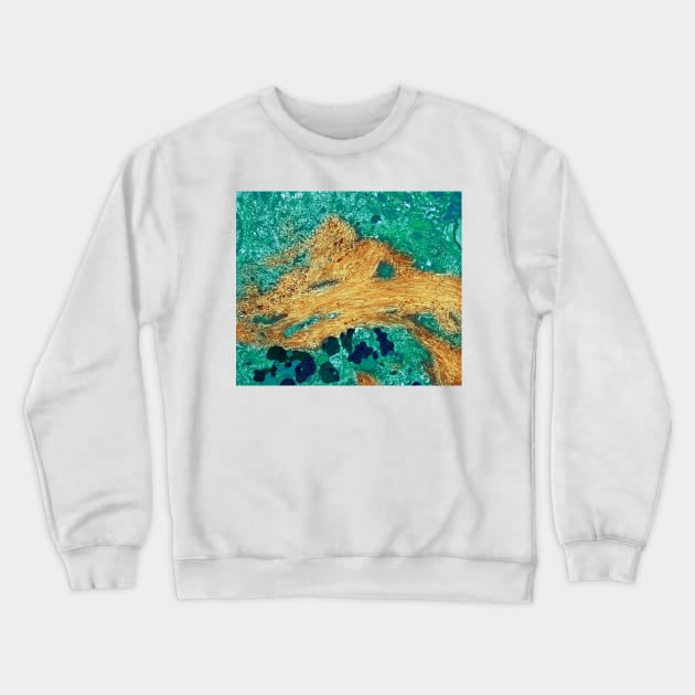 Alzheimer's disease brain cell, TEM (M108/0731) Crewneck Sweatshirt by SciencePhoto